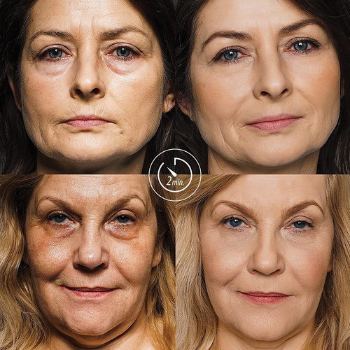 Hermz Agelxr Błyskawiczne Liftingujące Serum do Usuwania Zmarszczek 10x0.6ml