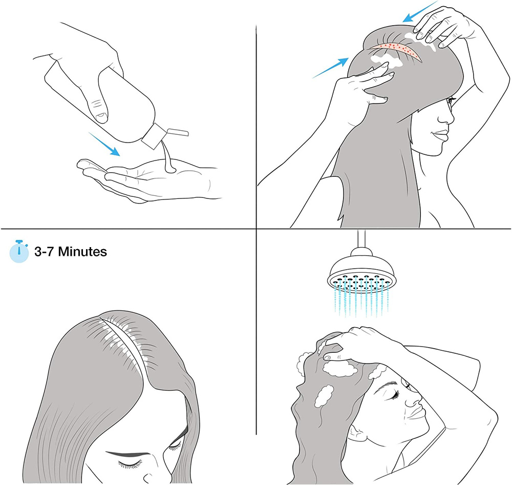 Hermz Healpsorin Shampoo for Psoriasis and Seborrheic Dermatitis 500ml